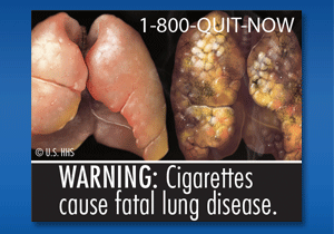 US government tobacco warning labels released June 20, 2011 - Warning: cigarettes cause fatal lung disease 1-800-QUIT-NOW - U.S. HHS