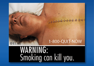 US government tobacco warning labels released June 20, 2011 - Warning: smoking can kill you - U.S. HHS